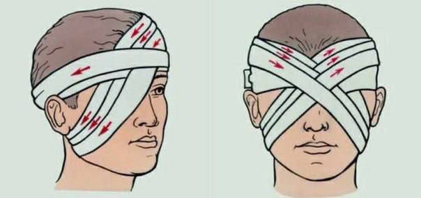 Первая помощь при травме глаза: советы инструктора тактической медицины