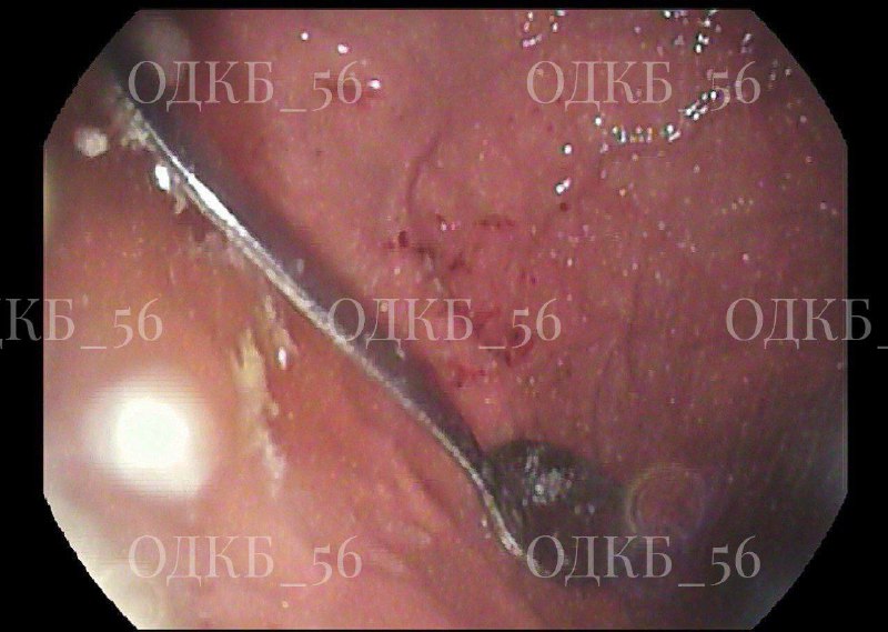 Иллюстрация 2