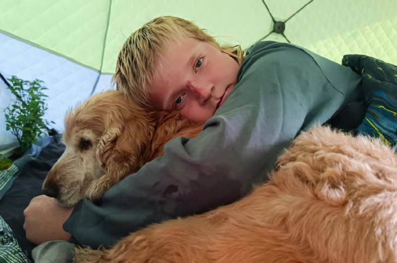 Мальчику нужна помощь для реабилитации после ожогов