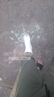 Контрактника избили сослуживцы, командир отказывается переводить