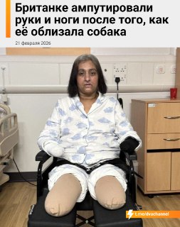 Британка лишилась конечностей из-за укуса собаки