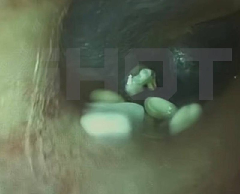 Россиянка пронесла контрабанду камней с Бали в ухе