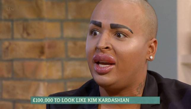 Смерть британского блогера после косметической операции