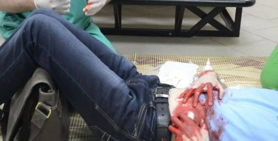 Осложнения абдоминальной травмы: диагностика и лечение