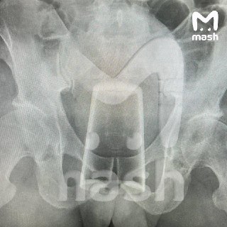 Иллюстрация 2