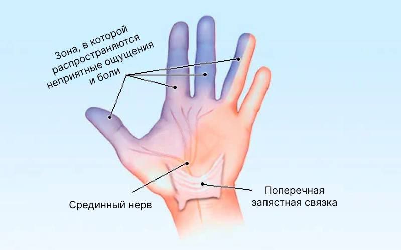 Иллюстрация 1