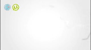 Разработка кибернетических протезов для бойцов СВО