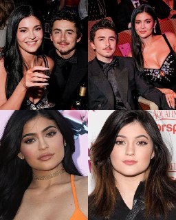 Кайли Дженнер изменила форму губ