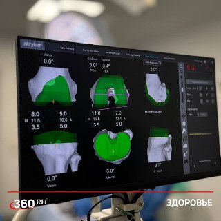 Первый робот-хирург начал работать в Подмосковье