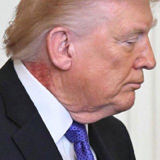 Обсуждение состояния здоровья Дональда Трампа