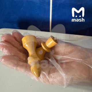 Житель Уфы засунул шахматные фигуры в прямую кишку и попал на операцию