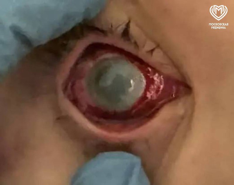 Эксперимент из интернета едва не лишил школьников зрения