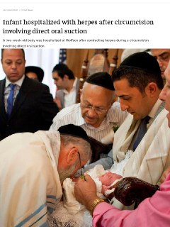 Младенец в реанимации после ритуального обрезания в Израиле