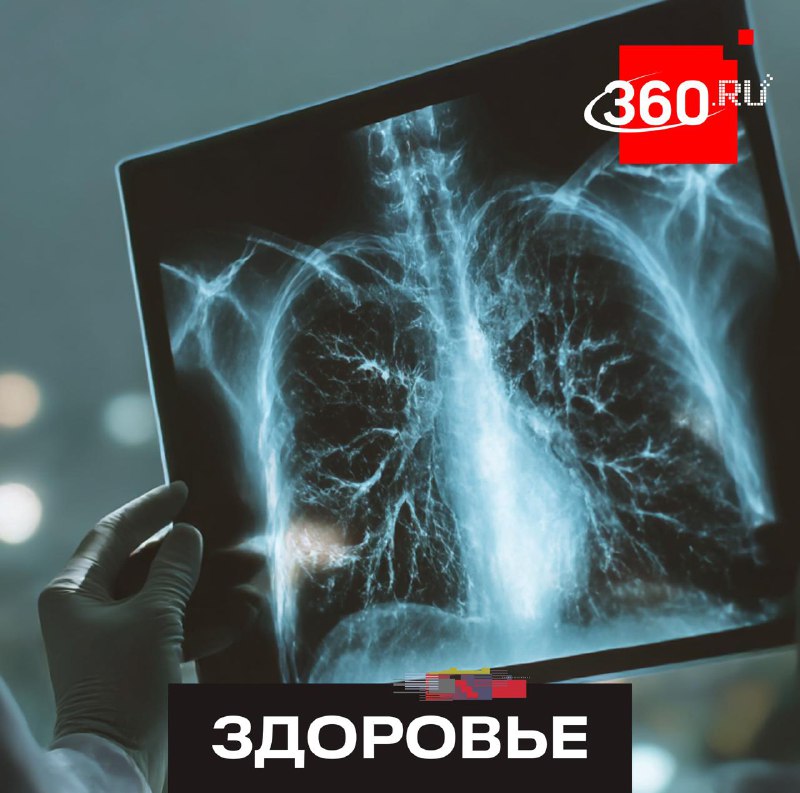 В Подмосковье запустили новый скрининг рака легких для курильщиков