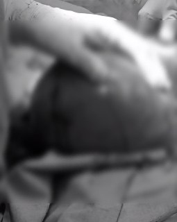 В подмосковной больнице удалили опухоль размером с беременность