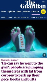 Новый тренд в косметологии: «зомби-филлер» из жира умерших