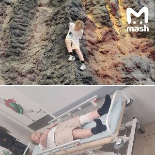Школьник сломал позвоночник в «Острове мечты»: парк заплатит 400 тысяч рублей
