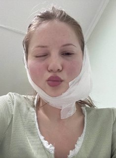 Девушка потеряла мимику лица после удаления зуба мудрости во Владивостоке