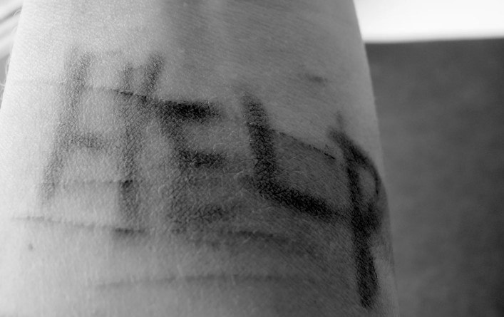 Исследование: стандартная психотерапия хуже работает для мужчин при селфхарме