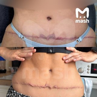 Больше десяти пациенток изуродовали в элитной клинике в Томске