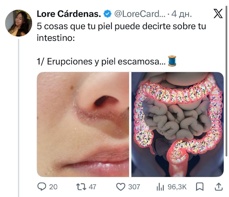 Связь состояния кожи и здоровья кишечника: основные признаки