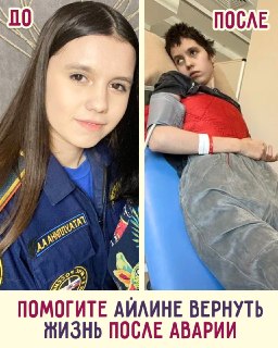 Студентке колледжа МЧС требуется помощь в реабилитации после тяжелой аварии