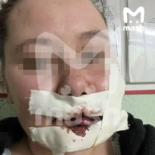 Жительница Уфы получила мизерную компенсацию за травмы в аварии со скорой помощью