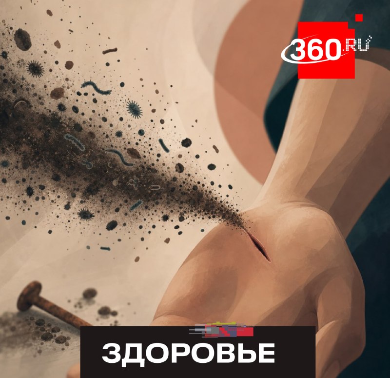Как не встретить столбняк: советы врачей по профилактике инфекции
