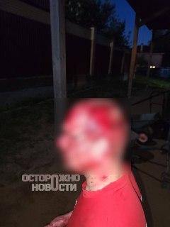 В Мытищах мужчина напал на соседа с вилами из-за спора о проезде