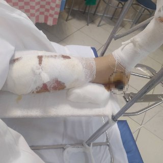 Суд в Краснодаре отказался возбуждать уголовное дело против водителя, сбившего ребёнка на переходе