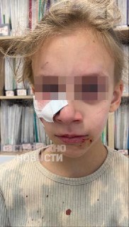 В Краснодаре бродячая собака напала на школьницу во дворе школы