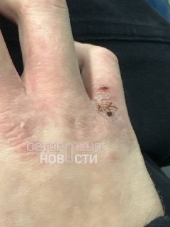 Экс-сотрудник обвинил «Вкусно — и точка» в Москве в переработках и эксплуатации при дерматите