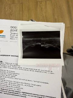 Москвичке повредили шею во время массажа в салоне Lamia Spa