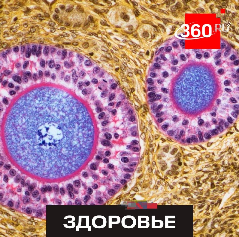 Ученые выяснили, что яичники продолжают активно работать после менопаузы