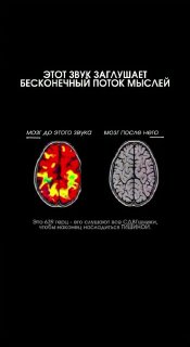 В сети завирусился звук, помогающий людям с СДВГ сосредоточиться