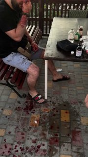 В Затоке мужчина арматурой избил ВСУшника из-за замечания о русской музыке