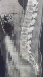 Житель Одессы попал в больницу после случайного падения на предмет сексуального характера