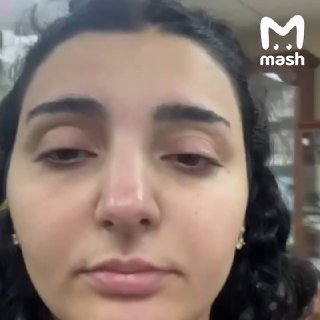 Жительница Тюмени получила химический ожог глаз после использования термогеля для ресниц PUSY