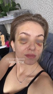 Житель Калининграда преследует бывшую жену и громит её квартиру