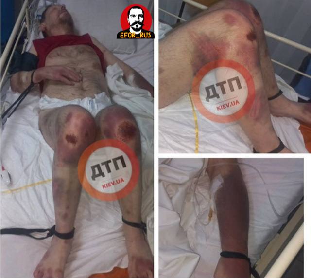 ТЦК объяснили инцидент с мужчиной на фото тем, что он просто упал с кровати