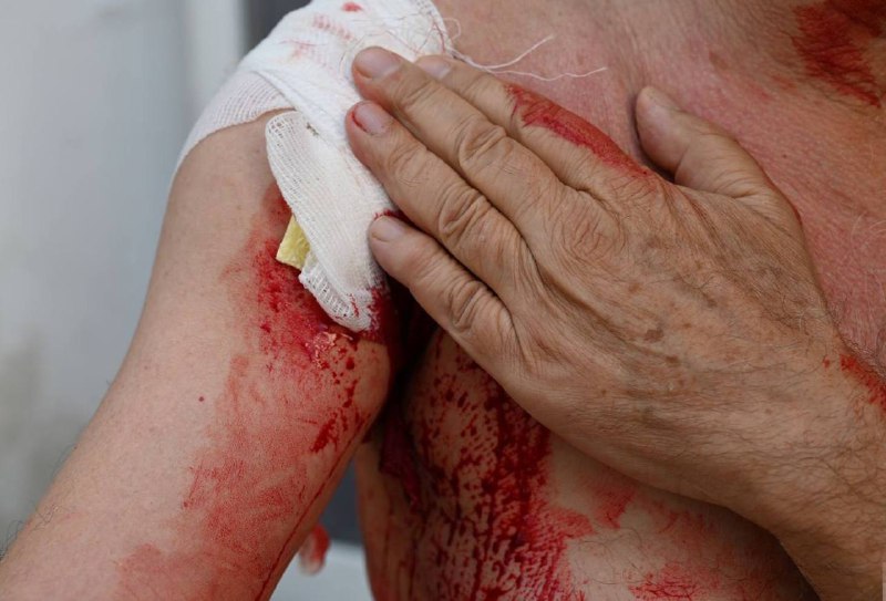 Эффективность тактических жгутов с пелотом в зонах конфликтов