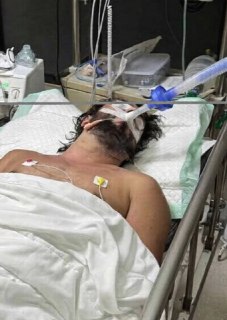 Турист из России умер на Бали после укуса змеи