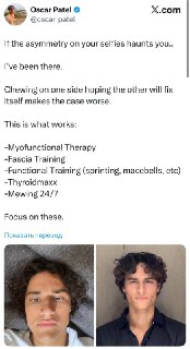 Как исправить асимметрию лица: подробная инструкция