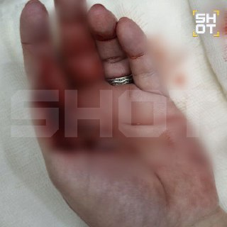 На Мальдивах акула напала на туристку