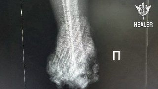 Оказание медицинской помощи военнослужащему после ранения