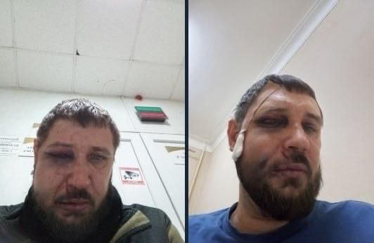 В Екатеринбурге избили журналистов проекта «Прекрасная Россия»