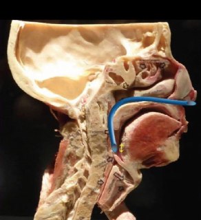 Важность назофарингеальных воздуховодов в тактической медицине